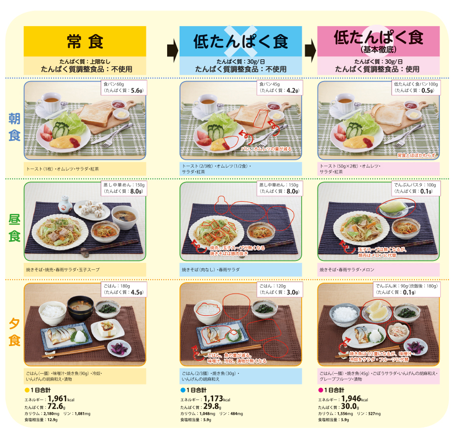 日本メディカルニュートリション協議会 食事療法 腎臓 Website
